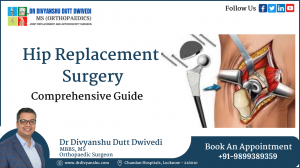 Best Hip Replacement Surgeon in Lucknow | Dr Divyanshu Dutt